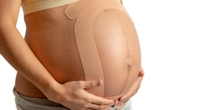 Kinesiotaping in pregnancy
